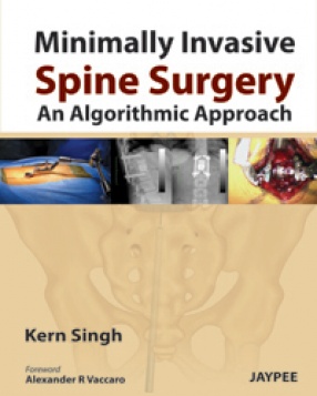 Minimally Invasive Spine Surgery: An Algorithmic Approach 