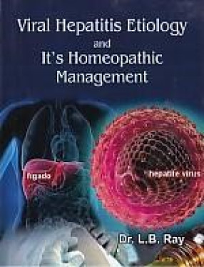 Viral Heaptitis, Etiology and it's Homeopathic Management